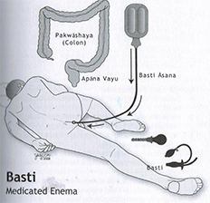 Basti: Lavman (Enema) Terapisi