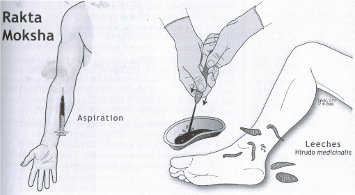 Rakta Moksha Terapisi